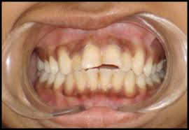 We did not find results for: Https Ispub Com Ijhe 6 2 4603