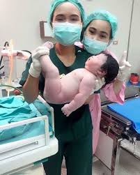 The Brave Mother Gave Birth To A Baby Weighing 5 2 Kg Follow Worldingram For More Via Browseart Worldingram Cute Babies Mother Baby