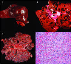 Dogs with short, white hair are at greatest risk for this type of hemangiosarcoma. Images Of Hemangiosarcoma Hsa Tumors From Dogs A Primary Hsa Mass Download Scientific Diagram