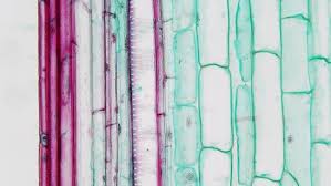 Check spelling or type a new query. Difference Between Simple And Complex Tissue Compare The Difference Between Similar Terms