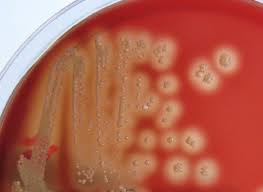 Image result for Group D Streptococcus