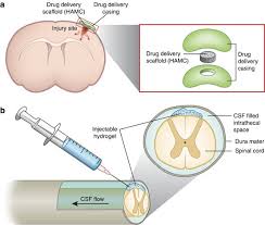 It controls everything from a sneeze to the rate of your heartbeat. Regenerative Therapies For Central Nervous System Diseases A Biomaterials Approach Neuropsychopharmacology