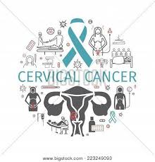 If the doctor feels the cancer cells are still inside the body then they might suggest radiation therapy. Cervical Cancer Vector Photo Free Trial Bigstock