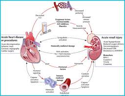 • reduced bf cause afferent vasodilation due to myogenic reflexes , no and pgi2. Examining The Key Symptoms Causes Of Kidney Failure