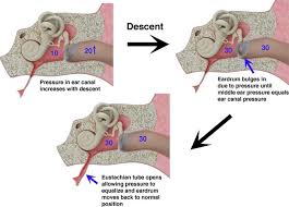 Eustachian Tube Dysfunction Ear Pressure Eustachian Tube Dysfunction Middle Ear