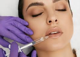 Dermal Fillers