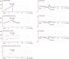 Evaluation Of Exercise Stress Test Ecg Symptoms Blood