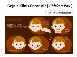 If you want to learn cacar air in english, you will find the translation here, along with other translations from indonesian to english. Gejala Klinis Cacar Air