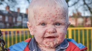 Herkes onun su çiçeği olduğunu sanıyor!