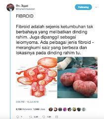 Gambar tanda tangan anda dengan mudah menggunakan kursor atau trackpad. Doktor Ini Hurai Dari A Z Tentang Bahaya Fibroid Dalam Kalangan Wanita