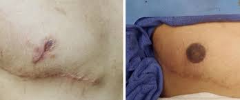 We did not find results for: Medical Tattooing In Newport Beach Orange County Ca