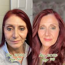 Finding healing in the truth that set her free. 🎨 😿 🎆 😑 💧  #MaternalLieExposed #MaternalRevelationsHere