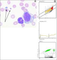 John Libbey Eurotext Annales De Biologie Clinique Automated Hematology Analysers And Spurious Counts