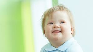 Trisomy 21 Down Syndrome News And Updates Children S Hospital Of Philadelphia