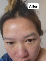 Sonya Sed Dial Soap Before and After