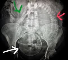 Pin On Women S Health