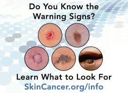 How to diagnose skin cancer. Skincancerfoundation On Twitter Early Detection Is Critical In Treating Skincancer Learn How To Identify Its Warning Signs Http T Co Zlj60mvxsd Http T Co Jim5rwhacx Twitter