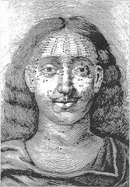 Defeating Depression