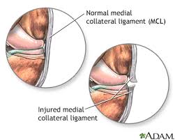 Discover more posts about my candy love, amor doce, amour sucre, corazon de melon, eldarya, cdm, and mcl. Torn Medial Collateral Ligament Medlineplus Medical Encyclopedia Image