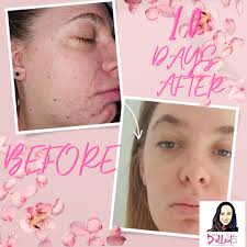 All Dolled Up Seaham Aesthetics and Beauty Clinic