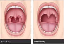 Image result for Adenodolichos