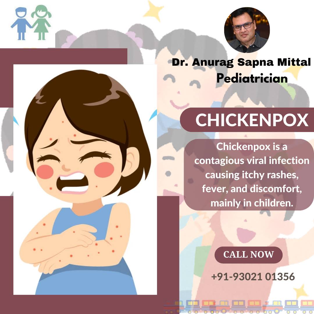 Chickenpox product image