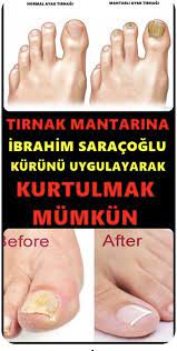 saglik panosundaki pin