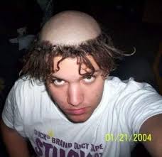 If you've ever had a bad haircut, and can relate, or if — god forbid — you're going through one right now, hopefully this article will help you feel less alone, and maybe even find new ways of coping. Really Bad Haircuts Gallery