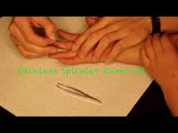 Once the splinter sticks to the tape, gently pull the tape from your skin. How To Painless Splinter Removal Youtube