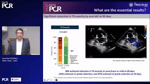 Triscend Study Demonstrates Significant Reduction In Tr With Evoque Tricuspid Valve Cardiovascular News