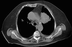 We did not find results for: Srim Societatea De Radiologie Si Imagistica Din Romania