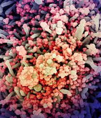 نتیجه جستجوی لغت [infect] در گوگل