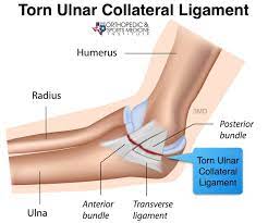 It's most commonly done on college and pro athletes, especially baseball pitchers. Tommy John Surgery Severs Baseball Community The Crusader