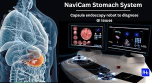 Image result for Virtual Endoscopy