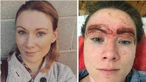 This site contains information about tattooed eyebrows gone wrong. Eyebrow Tattoo Horror Stories Why It Was The Worst Decision Ever