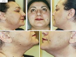 Karen — VILLANI MEDICAL