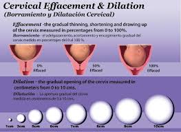 cervical effacement dilation chart birth doula cervical