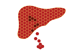 Este antigenul de suprafată al virusului hepatitei b, fiind markerul esențial al infecției; Testele Screening Pentru Hepatita ViralÄƒ B Si C Reginamaria Ro