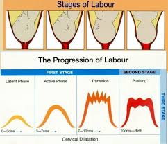 Image result for First Stage of Labor