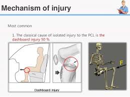 Pediatric dashboard description the 2.2 relative alcohol and drug injury indicators the relative alcohol and drug visualization displays the. Posterior Cruciate Ligament Reconstruction By Emad M Qasem
