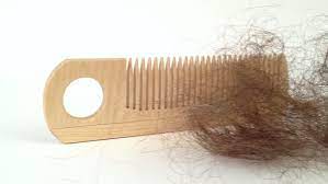 Some people lose hair in circular or patchy bald spots on the scalp, beard or eyebrows. Bunch Of Hair On The Stock Footage Video 100 Royalty Free 13229240 Shutterstock