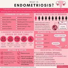 Endometriosis is a painful condition in which endometrial tissue grows outside the uterus, often in the pelvic area. Endometriosis Twitter Search