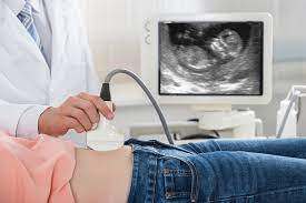 In a doppler ultrasound, the rate of blood flow is translated into a graph. What To Expect At Your First Ultrasound Parents