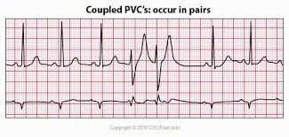 Ekg Ecg Interpretation Course Ceufast Nursing Continuing Education Ecg Interpretation Ekg Interpretation Continuing Education For Nurses