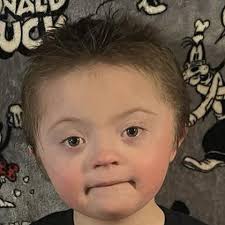 Fundraiser by James Tate : Help for Down Syndrome boy with medical issues