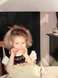 Uncombable Hair Syndrome Baby Face Hair Face