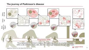 Parkinson's disease (pd) impacts people in different ways. Course Natural History And Prognosis Lundbeck Institute Campus