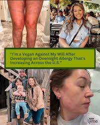 NEWS: @mit biologist Kevin Esvelt and researchers Joanna Buchthal and Sam  Telford have created the first genetically modified mouse resistant to Lyme  disease and capable of passing its immunity down to subsequent