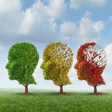 The degree of impairment at diagnosis can affect life expectancy. Why Don T We Have A Cure For Alzheimer S Disease
