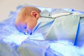 Signs And Symptoms Of Jaundice In Babies